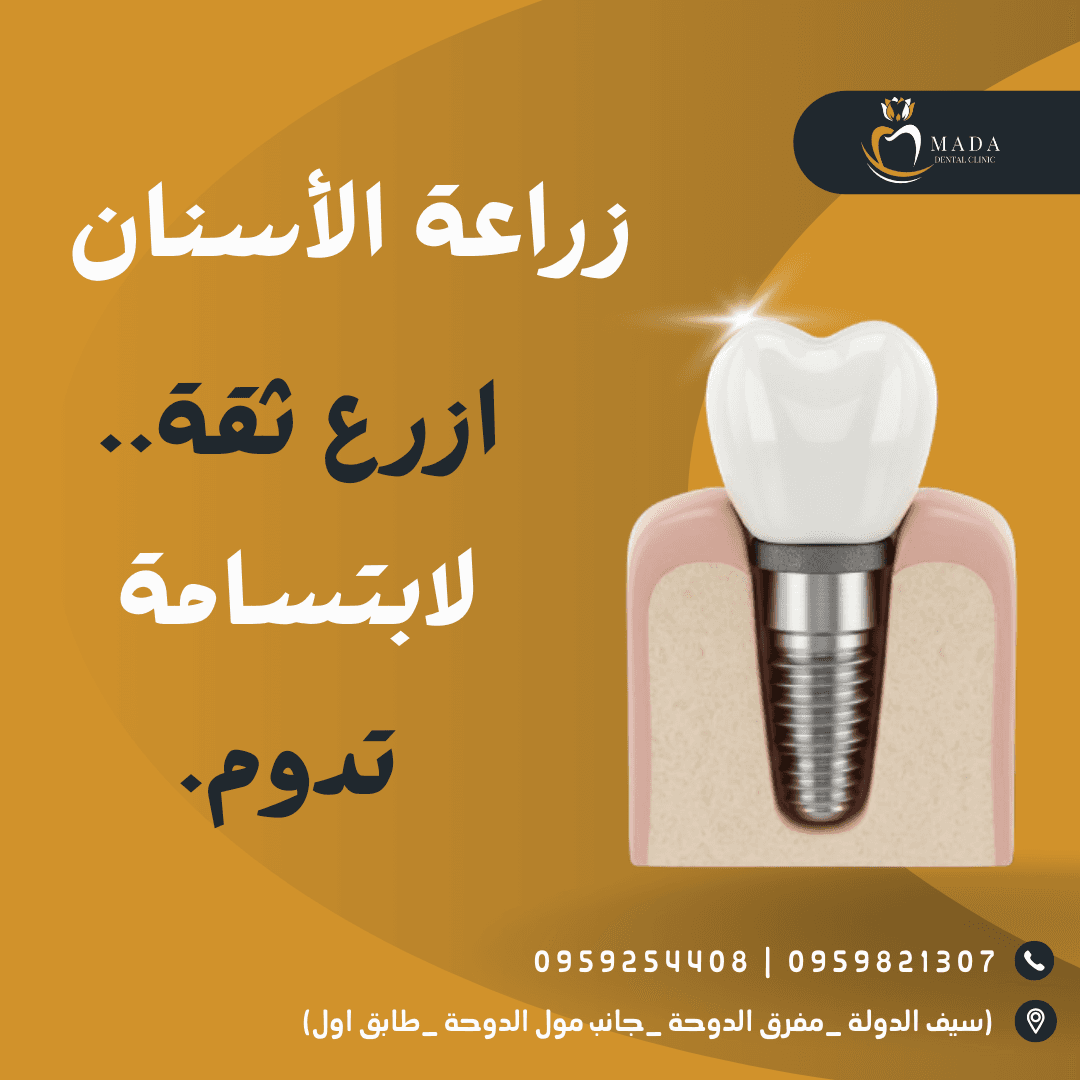 زراعة الأسنان - رعاية خاصة